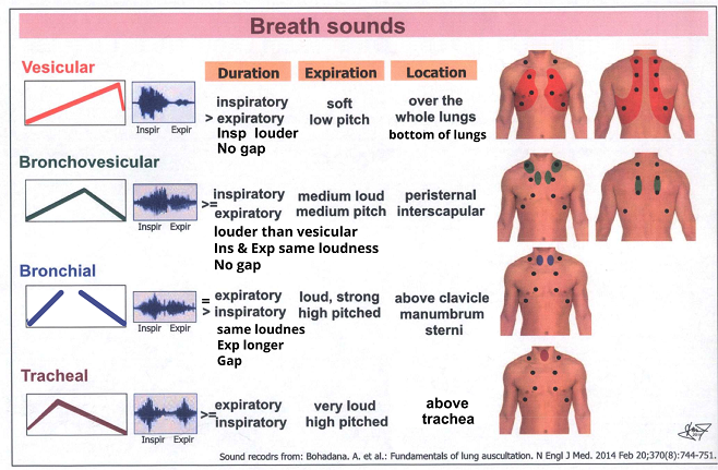 Tracheal breath sounds are heard over the trachea. These sounds are